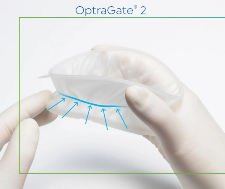 OptraGate 2 Ivoclar 80 sztuk Regular