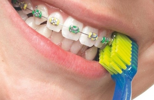 Curaprox Szczoteczka ortodontyczna CS 5460 ORTO