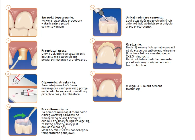 Implant Cement 5 ml