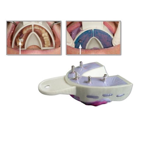 Łyżki wyciskowe do implantów