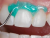 Koferdam OpalDam® Green