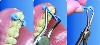 Kliny elastyczne do formówek sekcyjnych