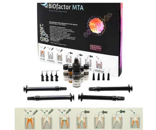 Biofactor MTA (Mineral Trioxide Aggregate) Materiał do wypełniania i naprawy kanałów korzeniowycj
