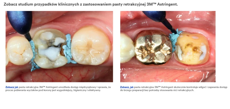 Pasta retrakcyjna Astringent